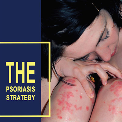 The Psoriasis Strategy PDF Download - Julissa Clay