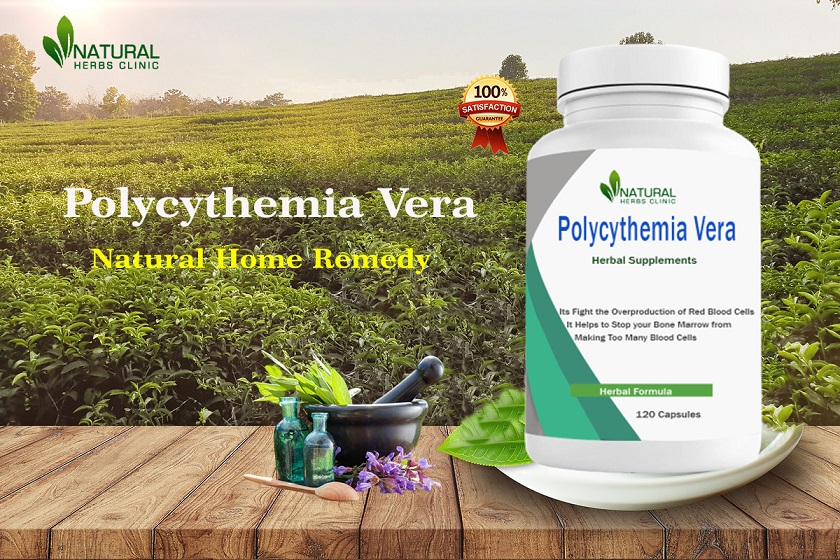 Polycythemia Vera Natural Treatments