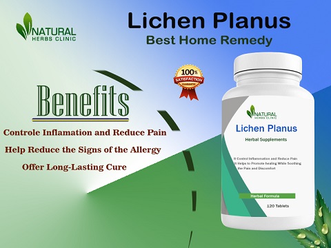 Benefits of Natural Remedies for Lichen Planus