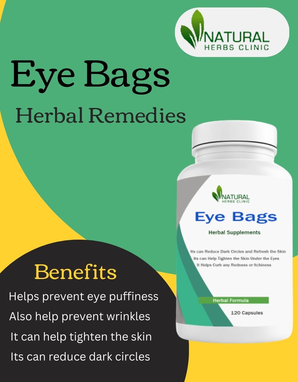 Get the Herbal Remedies for Eye Bags Natural Treatment