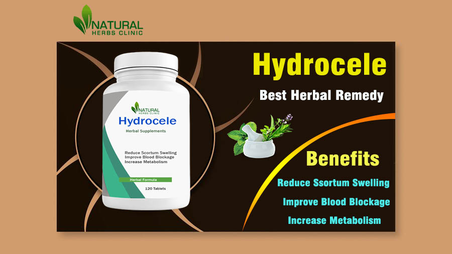 Hydrocele: Change Your Life Style Using Herbal Supplements