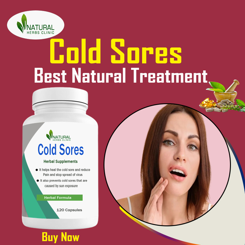 Effective Natural Treatments for Cold Sores: Say Goodbye to Painful Blisters