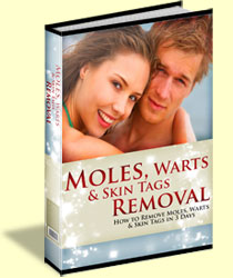 Moles, Warts & Skin Tags Removal™ PDF eBook Download
