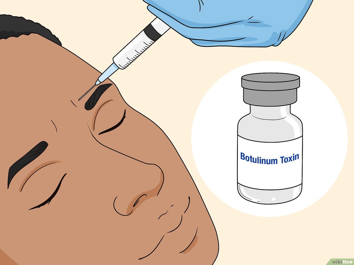 Botulinum Toxin Market Report Opportunities, and Forecast By 2033